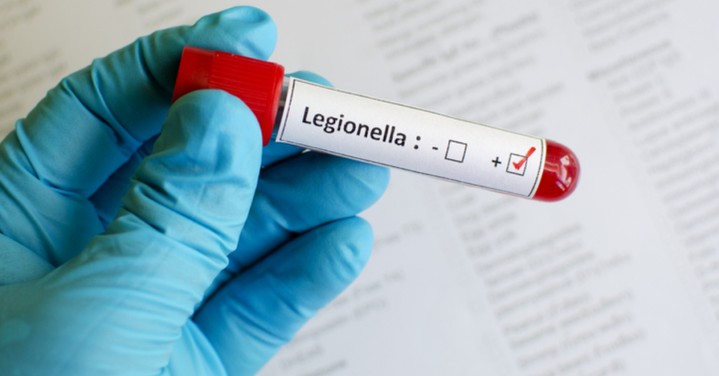 Health Alert: Experts Slam Baltimore’s Response to Legionella Threat